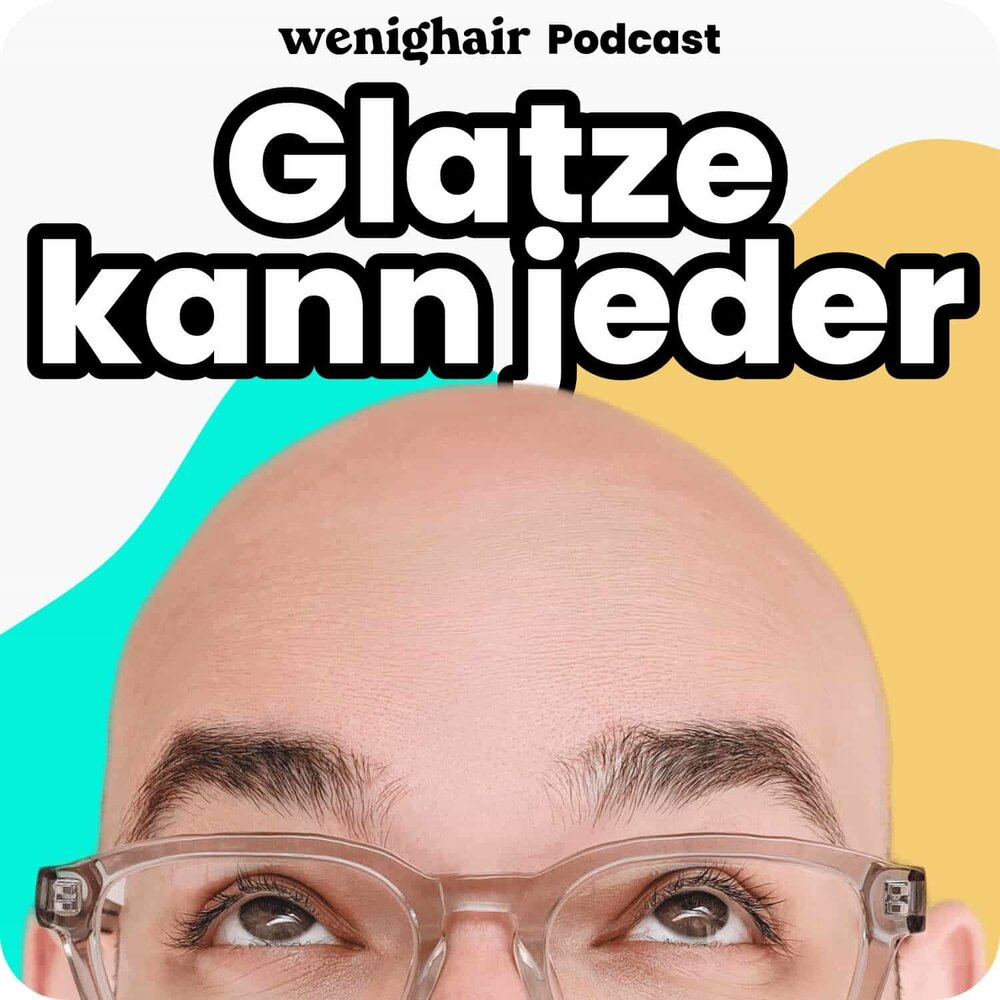 wenighair – Glatze kann jede:r